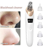 5 in 1 Multifunction Acne Pore Vacuum Suction Facial Cleaner Blackhead Remover| Beauty Expert INVOICE PAY